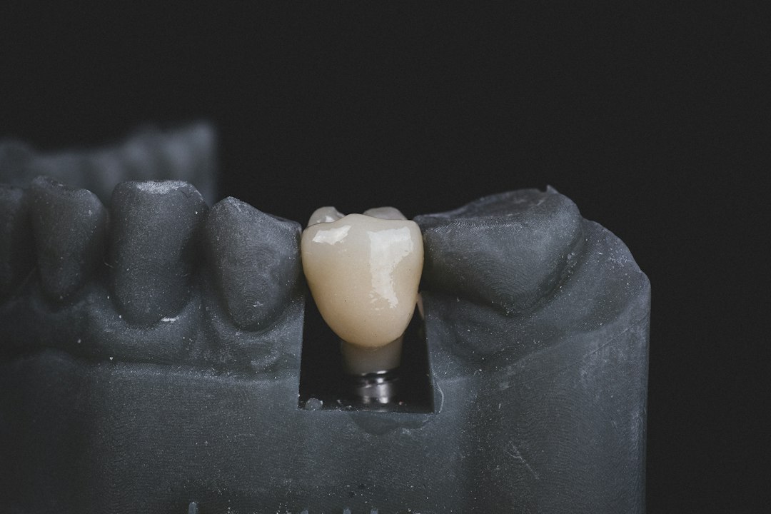 Dental Lab Software: Keep Cases, Files, Production, and Delivery in Step